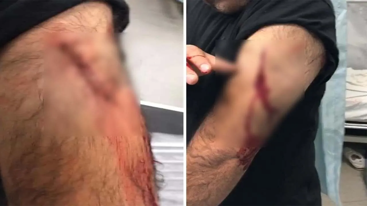 Şanlıurfa’da Öğretmene Jiletli Saldırı